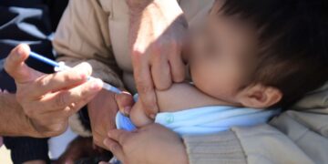 Con nuevo módulo de oftalmología, Salud beneficia a menor en “Martes Ciudadano”