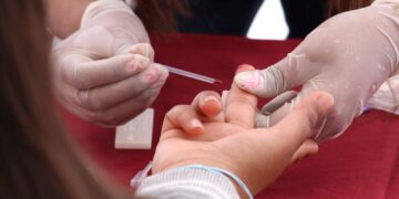 En “Martes Ciudadano”, Salud fortalece cultura de la prevención contra cáncer de próstata