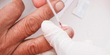 Con esterilizaciones, Salud busca reducir enfermedades que afecten a la población