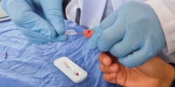 Médicos especialistas otorgan consultas ortopédicas en “Martes Ciudadano”