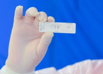 Registra Puebla 20 casos activos de COVID-19: Salud