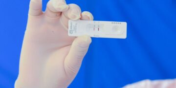 Registra Puebla 20 casos activos de COVID-19: Salud