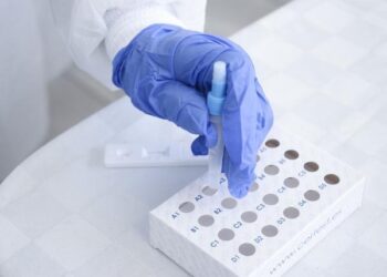 Permanecen nueve personas hospitalizadas por COVID-19: Salud