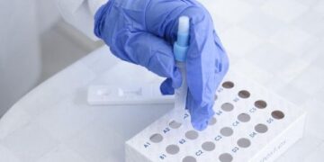 Permanecen nueve personas hospitalizadas por COVID-19: Salud