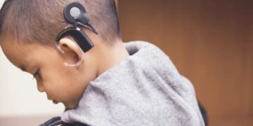 SCJN obliga al IMSS a otorgar prótesis y audífonos a menores; Batres rechaza por impacto financiero